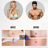 Bodylaser 3000 - Depilador Definitivo